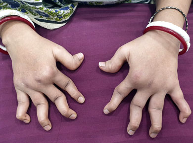 Thumb